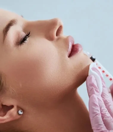 10 Common Questions About Dermal Fillers