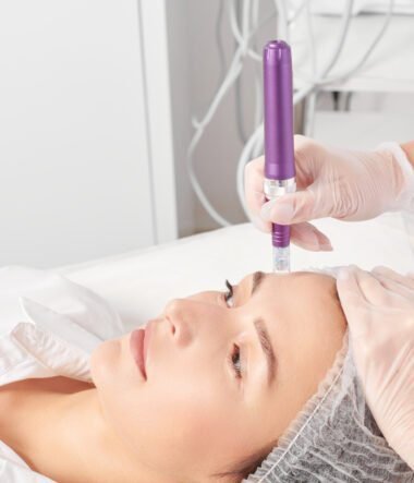 5 Key Benefits of Microneedling Treatment for Rejuvenated Skin