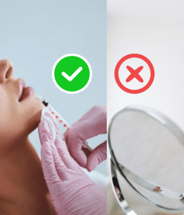 The Do’s and Don’ts After Getting Dermal Fillers