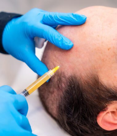 PRF vs PRP for Hair Restoration: Which Is Better?