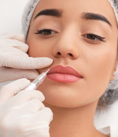 How Long Do Lip Fillers Last? Everything You Need to Know