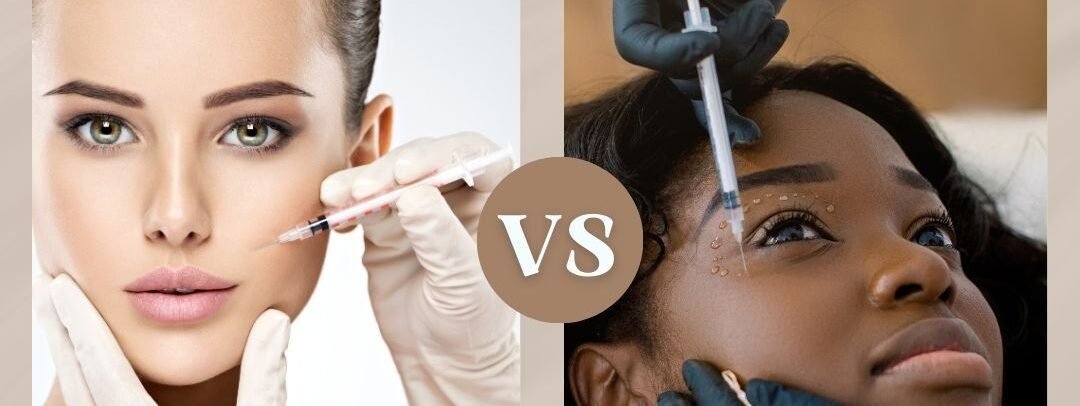 Botox vs. Dysport: Which One Works Better for Wrinkles in 2026?