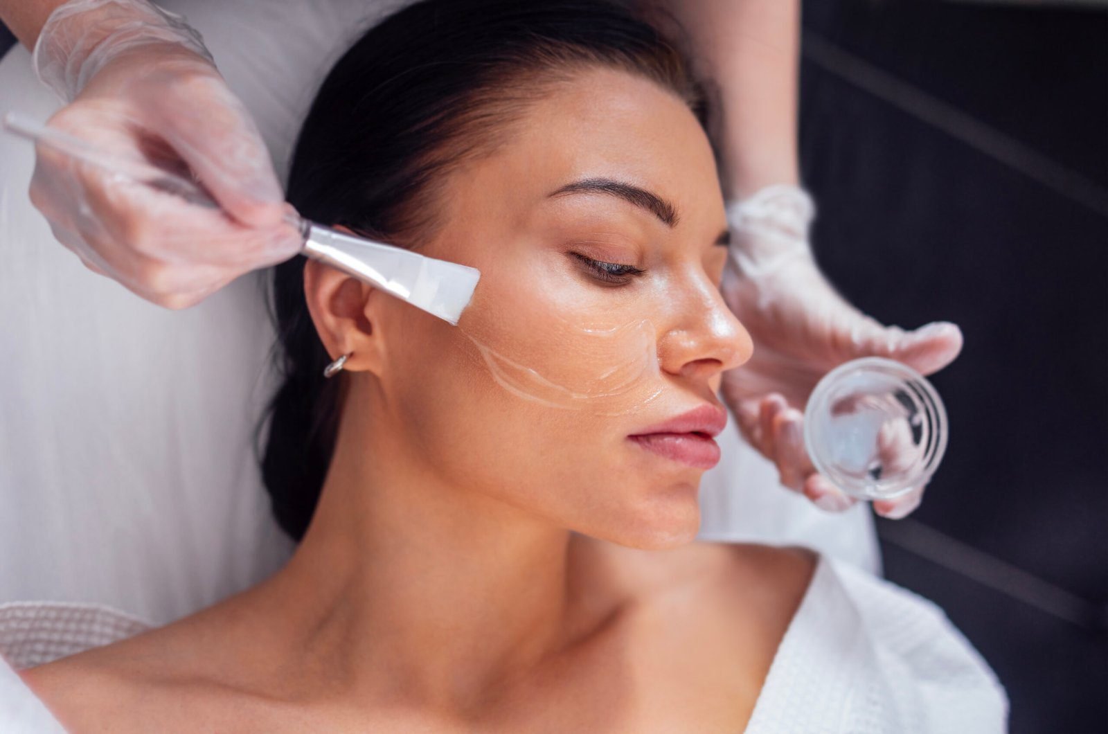 Patient receiving a chemical peel facial treatment by a professional wearing gloves.