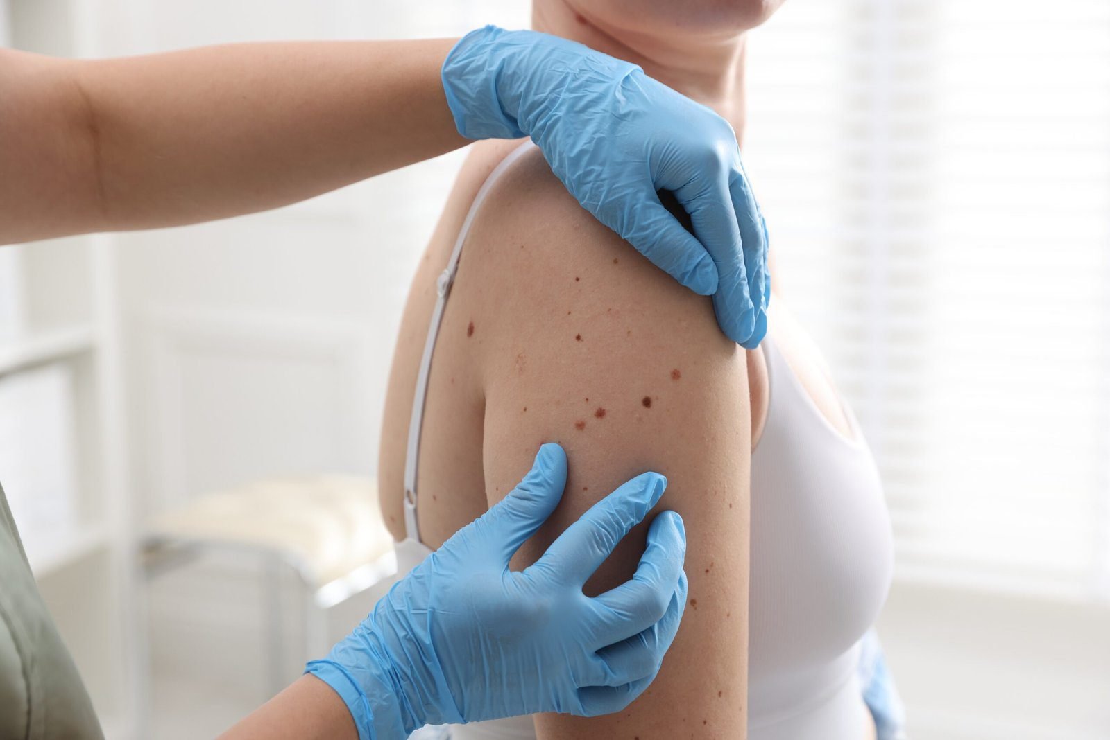 Patient receiving exosome facial treatment on shoulder and upper back by a professional wearing gloves.