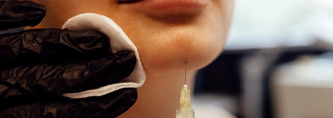 How Long Do Dermal Fillers Actually Last?