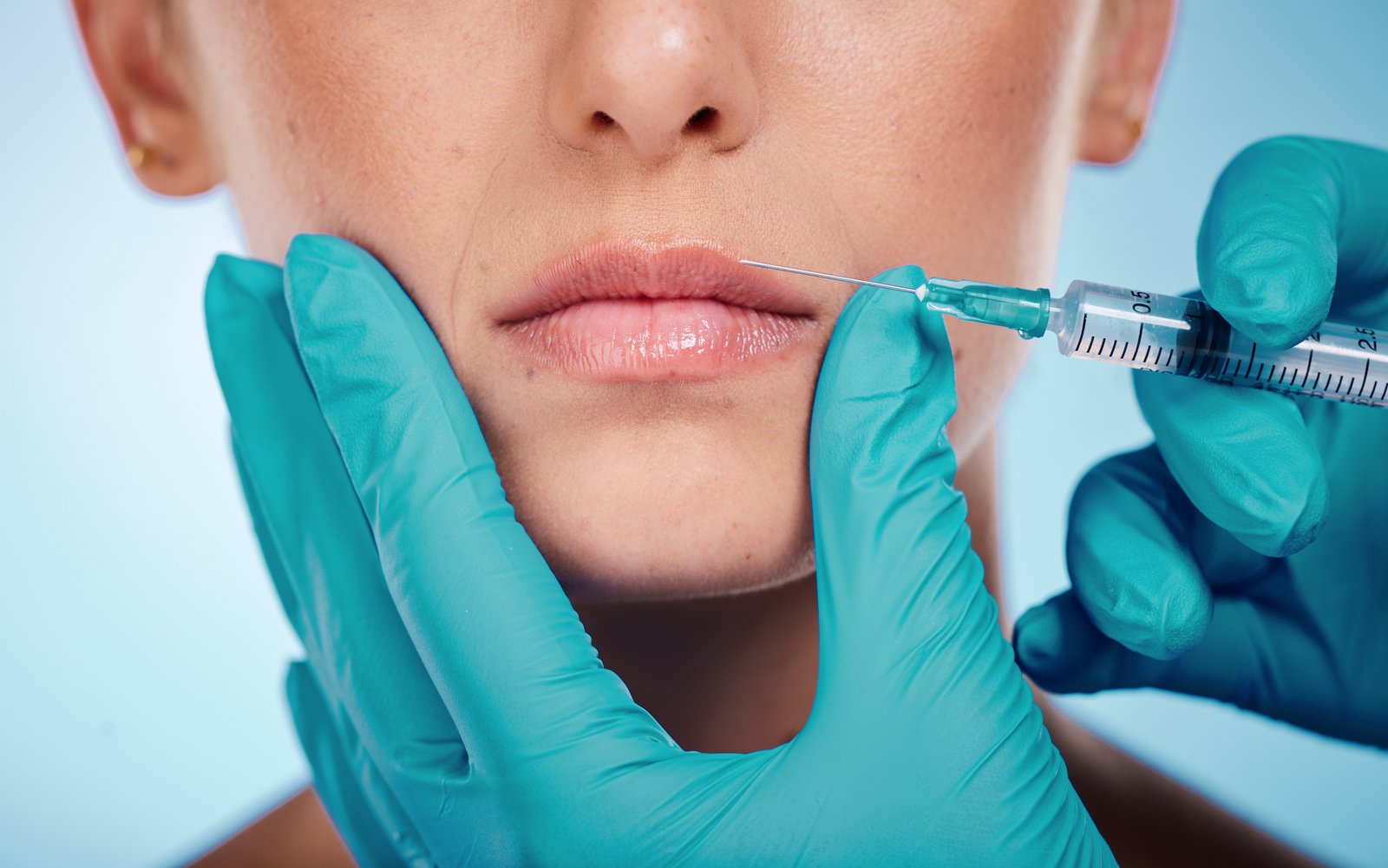 Questions to Ask Before Your First Dermal Filler Appointment