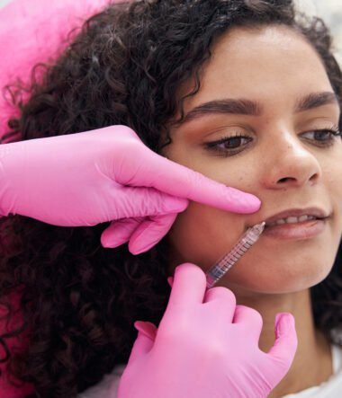 Dissolving Filler with Hylenex What to Know Before Undoing Dermal Fillers